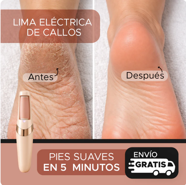 Removedor de Callos Eléctrico Recargable