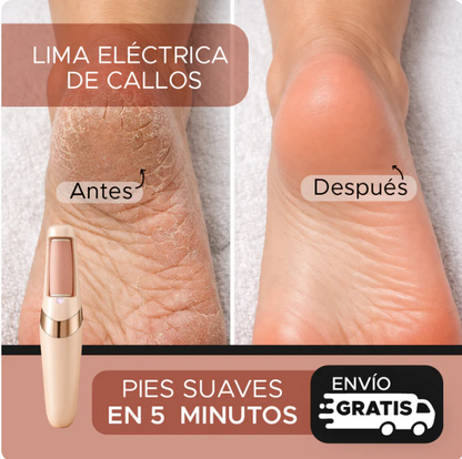 Removedor de Callos Eléctrico Recargable